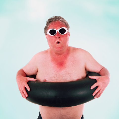 man wearing white sunglasses sporting a sunburn
